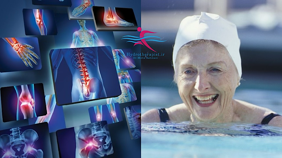 تأثیر آب‌درمانی بر بازتوانی بعد از جراحی‌های ارتوپدی: یک مرور سیستماتیک و علمی